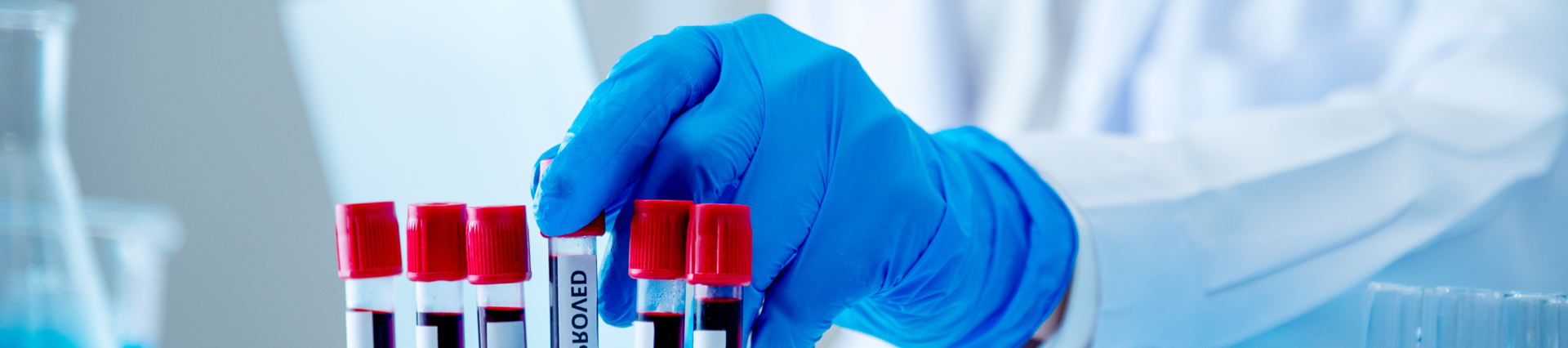 Lab tech handling blood donation samples in vials in accordance with blood donor compliance regulations